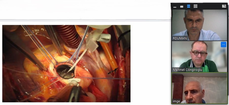 Modifiye Kalp Kapağı Yapılanmasına Ment&ouml;rl&uuml;k Desteği detayı için tıklayınız